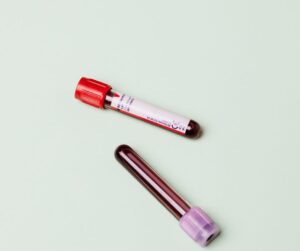 Vitamin D Testing